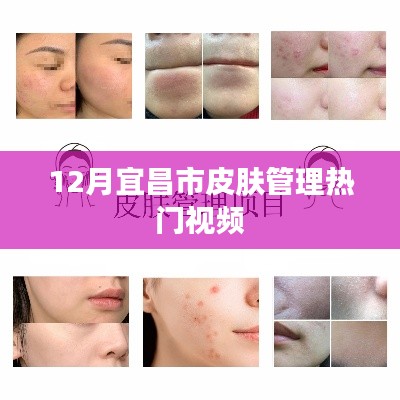 宜昌冬季皮肤管理热门视频推荐