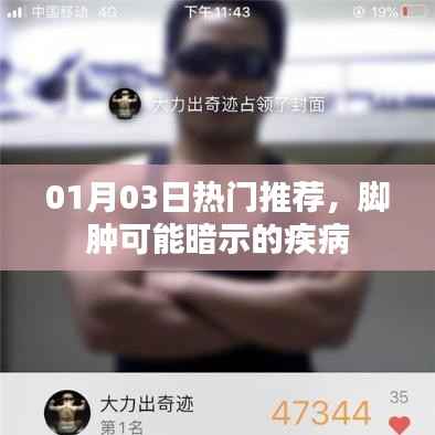 脚肿暗示疾病,热门推荐解读!